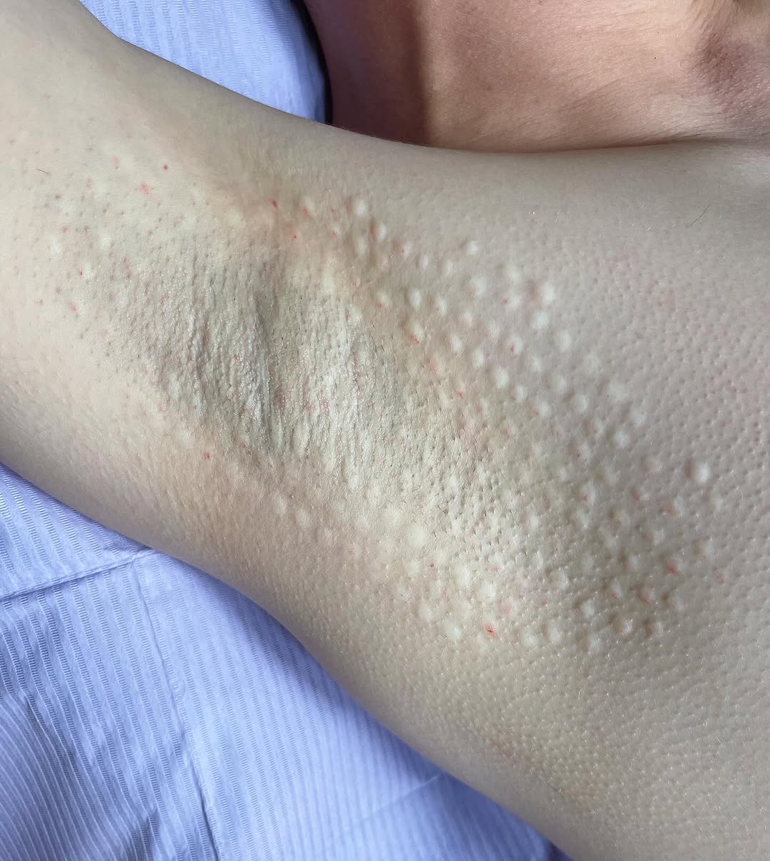 Materiał dotyczący skóry i jakości tkanek